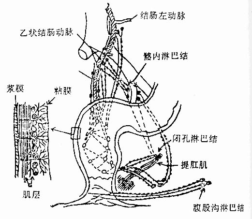 直肠癌晚期的具体症状有哪些